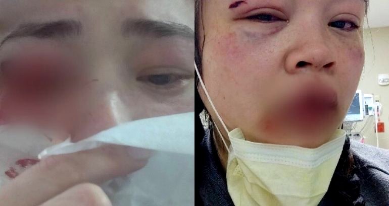 Nail Technician Brutally Beaten By Man Who Followed Her Off Train in Dallas