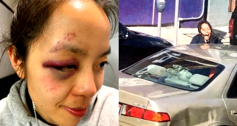 SF Woman Beaten and Dragged by Robbers Has Message: ‘I Forgive You’