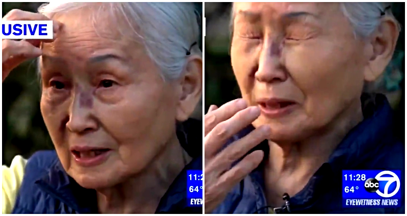 Charges Dropped Against Man Who Beat, Spit on 83-Year-Old Korean American Woman