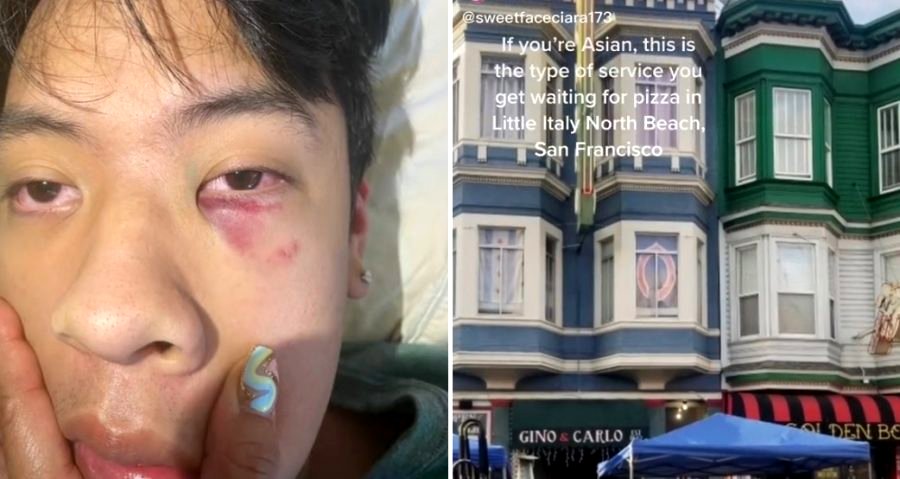 Sports Bar Owner Allegedly Gets Death Threats After Filipino American Teen is Assaulted Outside  in SF