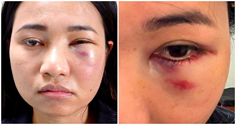 Thai Woman Punched and Robbed on Her Way to Work in SF Chinatown