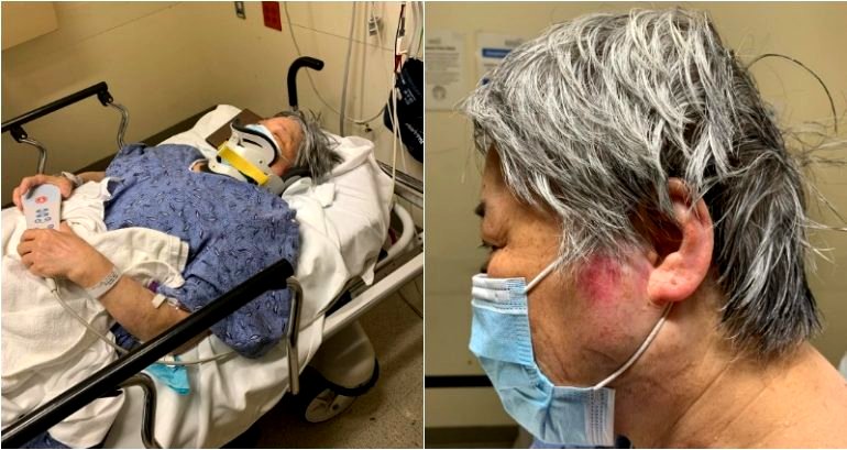 Asian Grandmother, 67, Allegedly Beaten Up During Violent Robbery in Boston