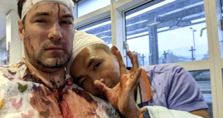 Gay couple left bloodied and injured after homophobic attack in the UK