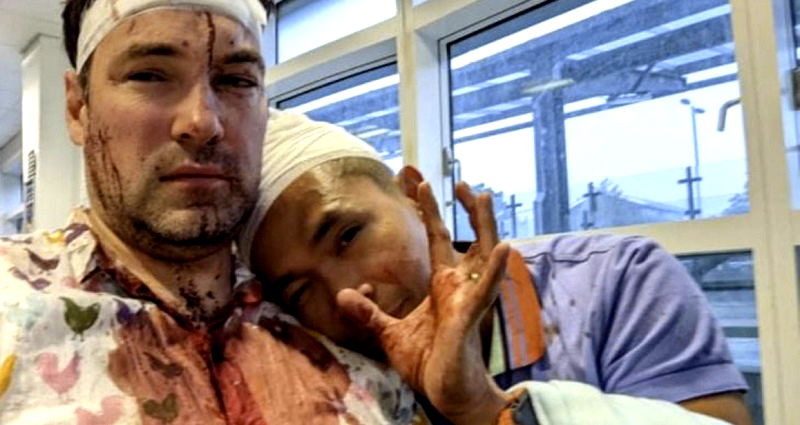 Gay couple left bloodied and injured after homophobic attack in the UK