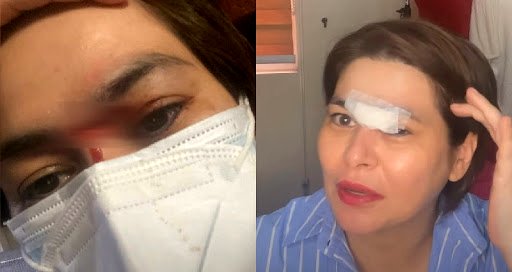 Filipina actress needed stitches after eating spicy ramen