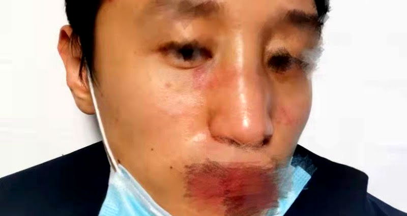 Chinese man brutally beaten by mob of racist teens starts petition to Stop Asian Hate in Cambridge