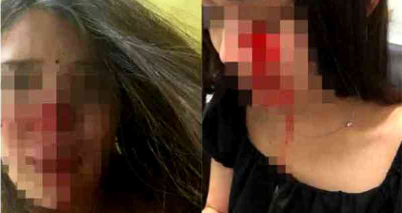 Thai woman is reportedly beaten by Datuk Seri in Malaysia after pulling away from his sexual assault