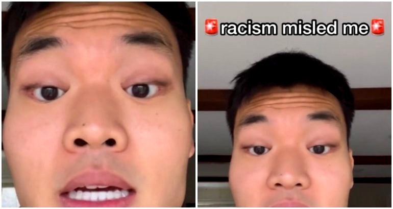 Racism or medical condition?: TikToker finds explanation for why he can’t open his eyes wider