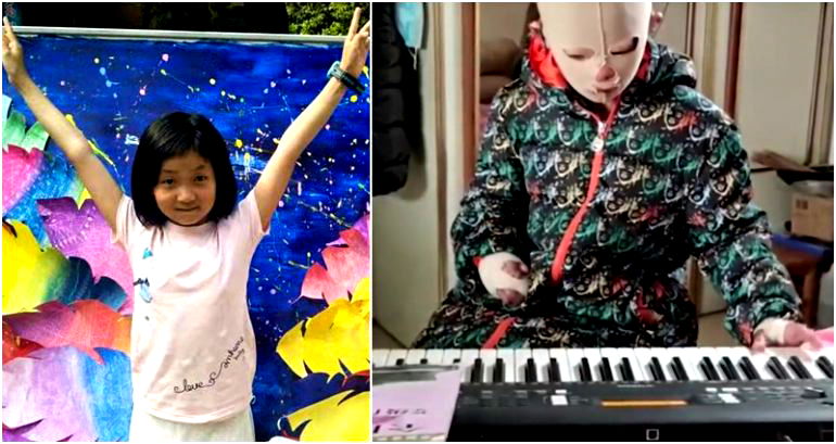 Chinese girl, 11, inspires millions by continuing to play the piano after a fire burned most of her body