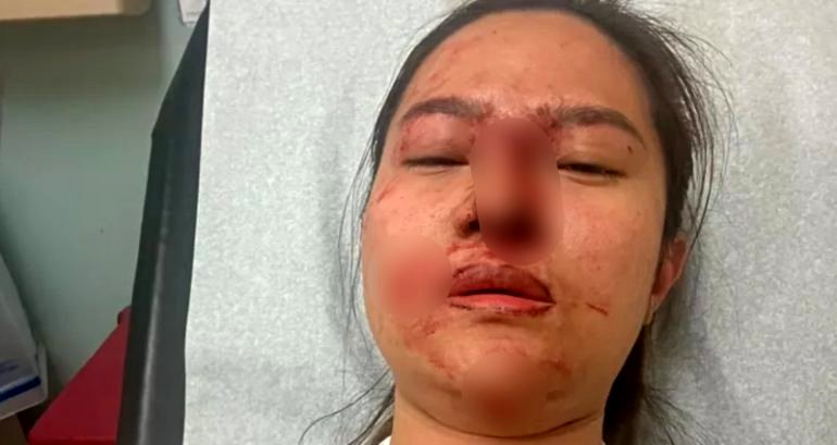 Cambodian American woman in shock after brutal robbery outside California supermarket