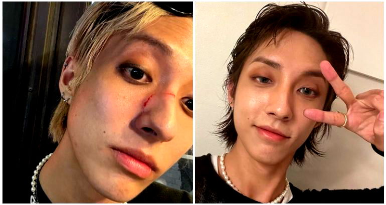 First openly gay K-pop idol Holland says he was attacked in Itaewon, called ‘a dirty gay’