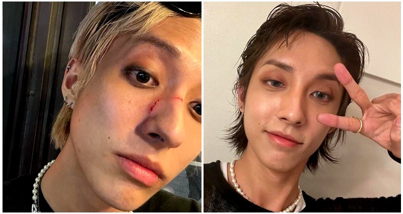 First openly gay K-pop idol Holland says he was attacked in Itaewon, called ‘a dirty gay’