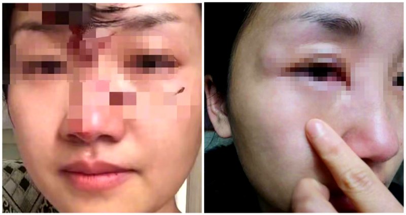 University in China bans professor whose wife alleges he beat her over 1,000 times
