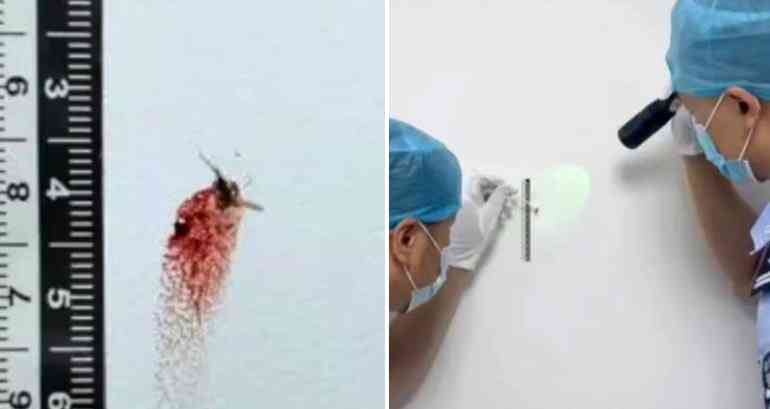 Mosquitos help solve home robbery case in China