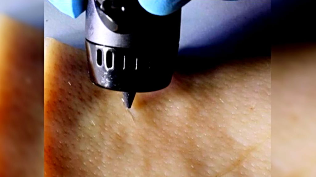 Chinese scientists develop ink that heals wounds via 3D-printing pen