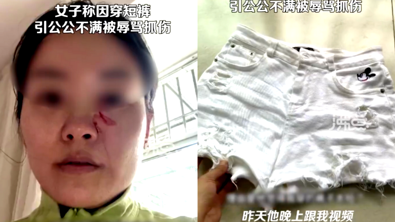 Chinese woman accuses father-in-law of assaulting her with hot soup over length of her shorts