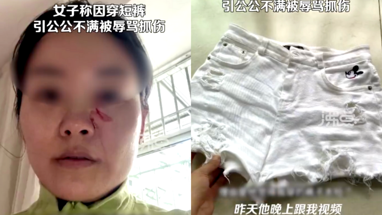 Chinese woman accuses father-in-law of assaulting her with hot soup over length of her shorts