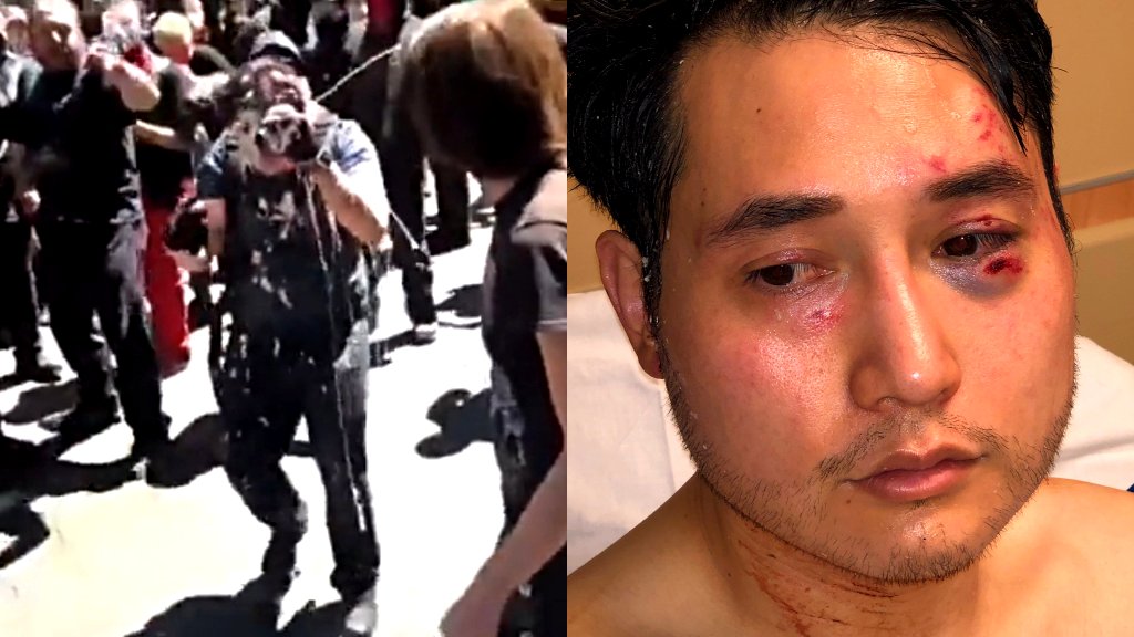 Conservative journalist Andy Ngo wins $300,000 from 2019 milkshake attackers