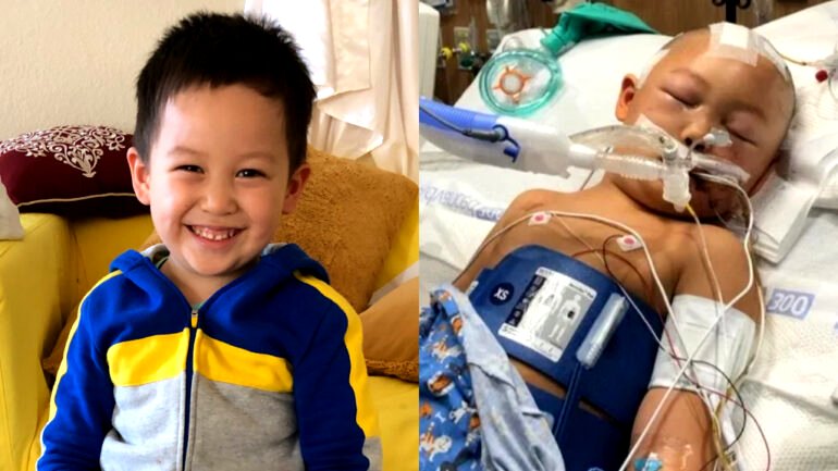 6-year-old attacked with baseball bat stable, makes ‘unexpected progress’