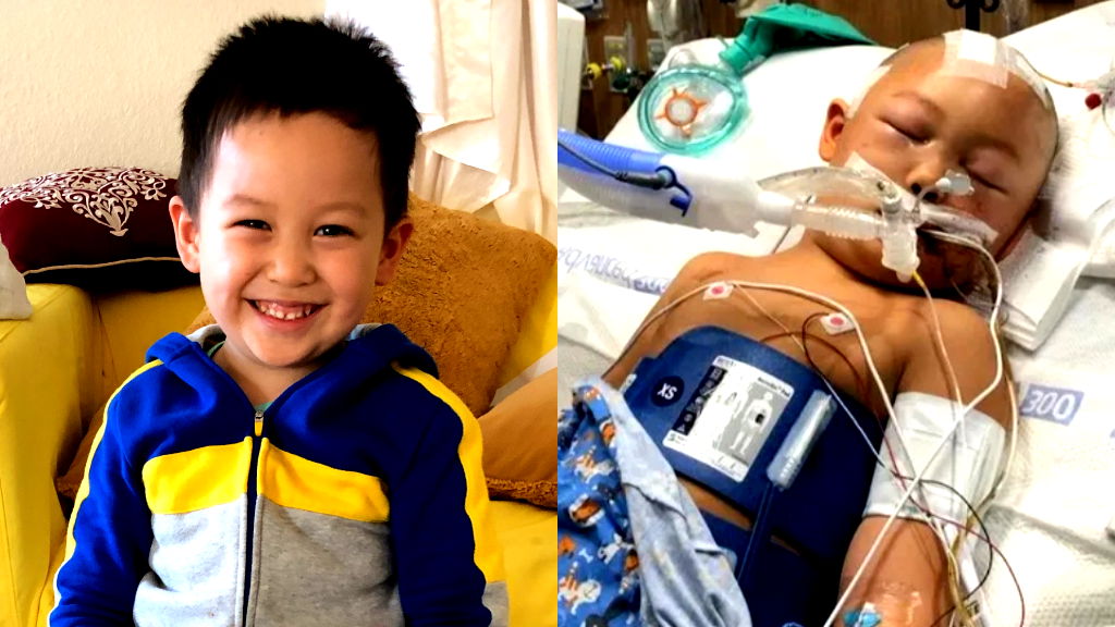 6-year-old attacked with baseball bat stable, makes ‘unexpected progress’