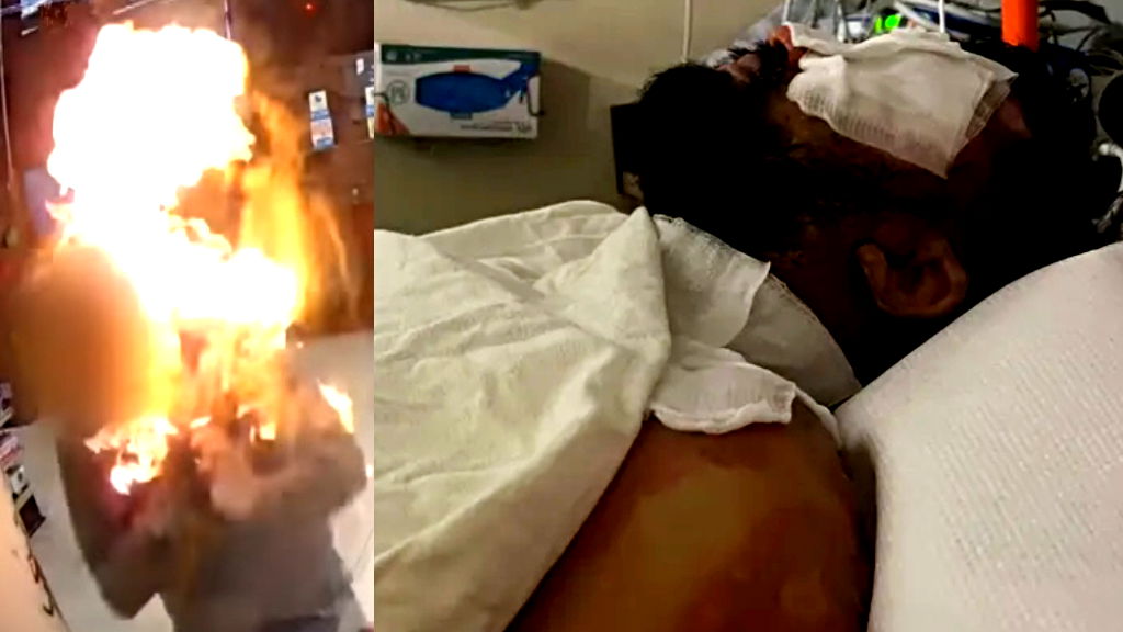 Store clerk recovering after alleged shoplifter sets him on fire in California