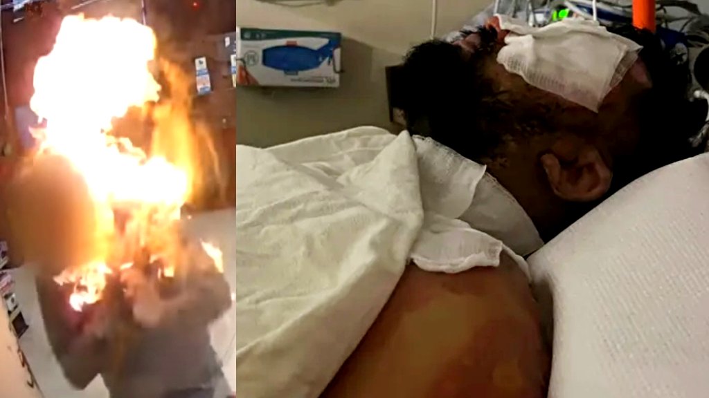 Store clerk recovering after alleged shoplifter sets him on fire in California