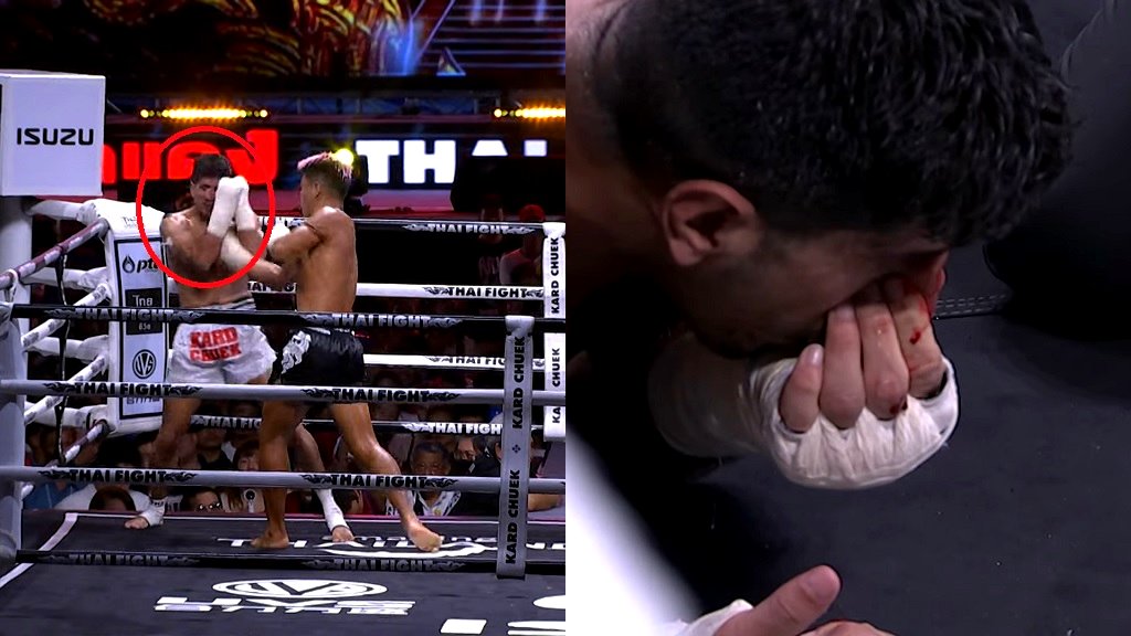 Video: Muay Thai fighter suffers horrific broken nose during match