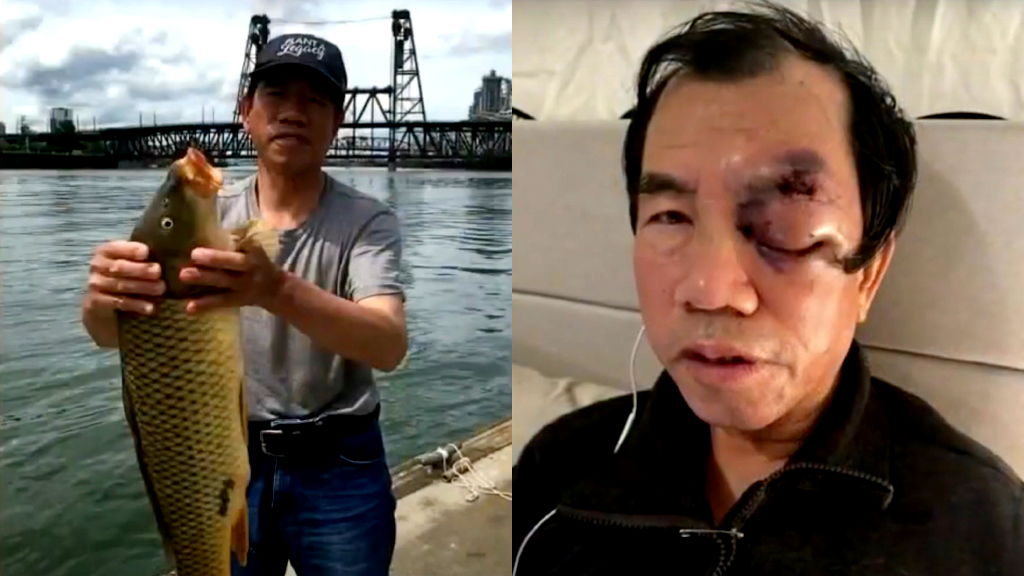 73-year-old Chinese man brutally beaten while fishing in Portland