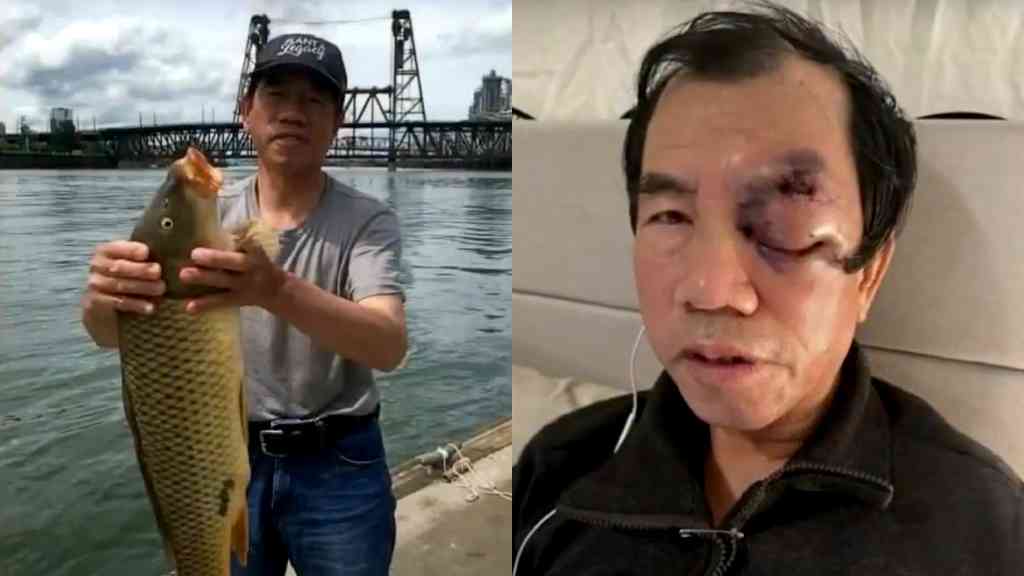 73-year-old Chinese man brutally beaten while fishing in Portland