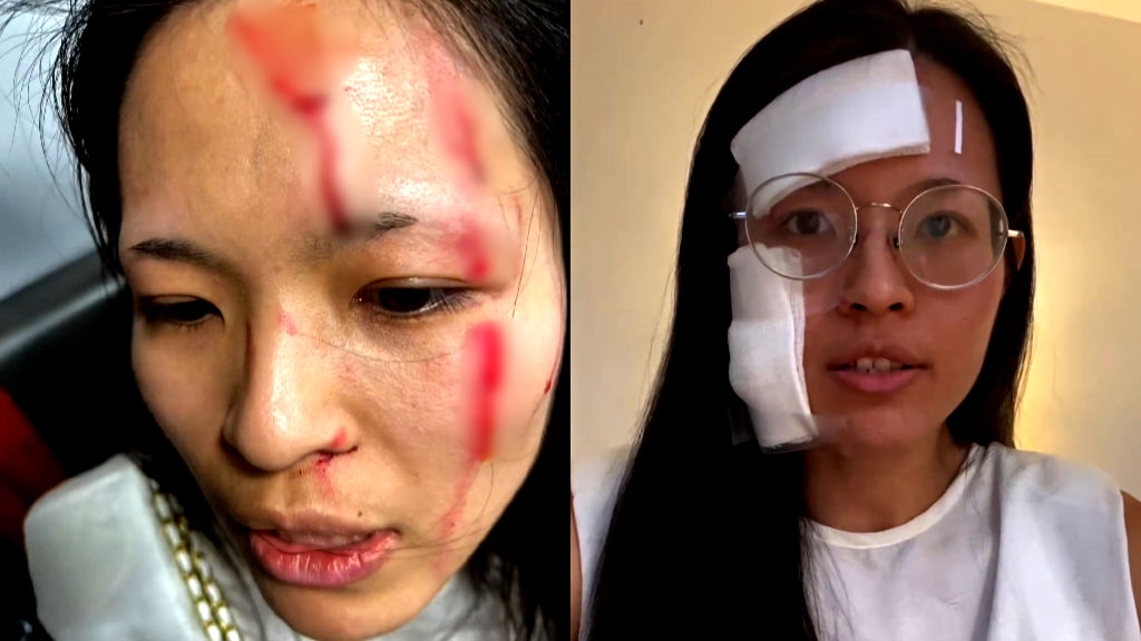 Asian woman ‘needs her city back’ after violent attack in NYC