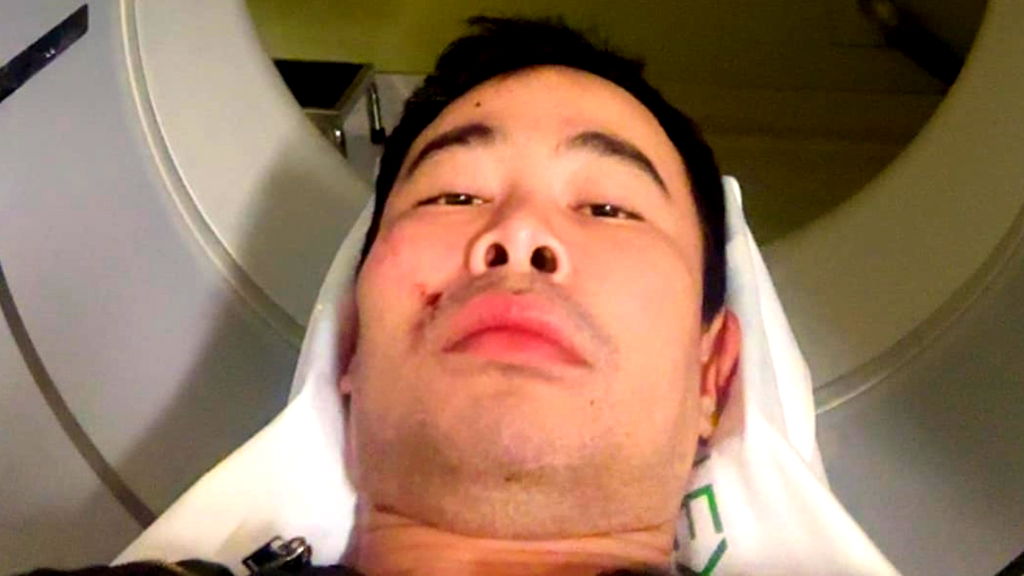 Queer Asian man assaulted in possible hate crime in San Francisco